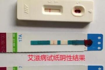 女的用嘴巴吃鸡会得HPV，小心口腔尖锐湿(附症状图片)